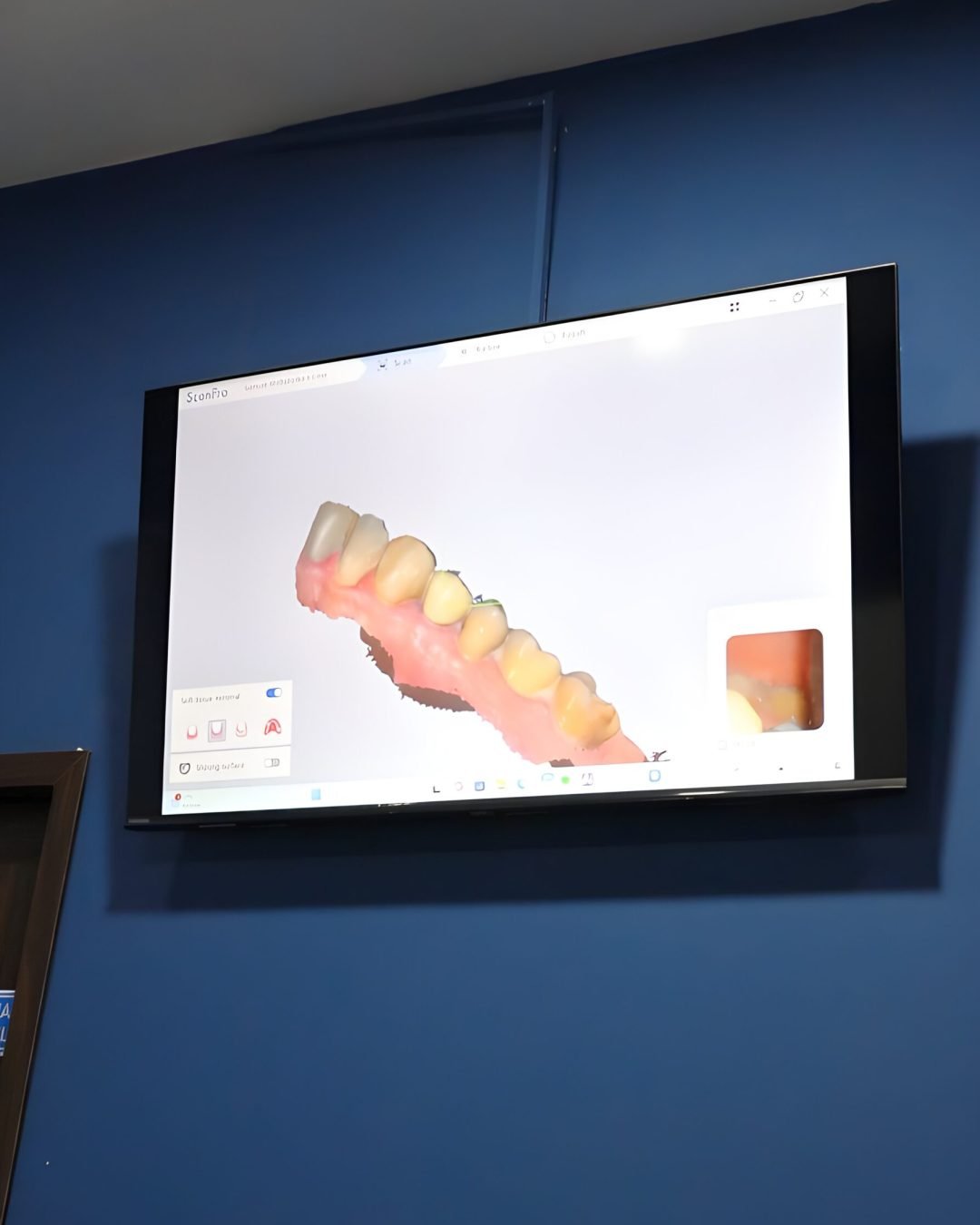 3D Scanner Gigi